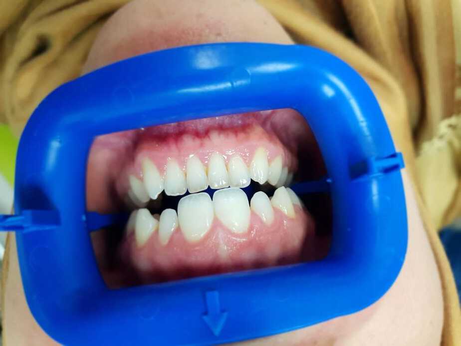 רופא שיניים בפתח תקווה