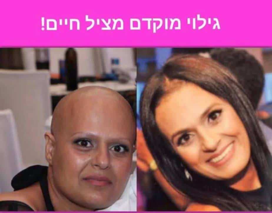 לפני ואחרי (צילום באדיבות שרית צאיג)