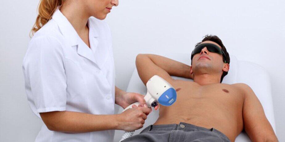 הסרת שיער לגברים