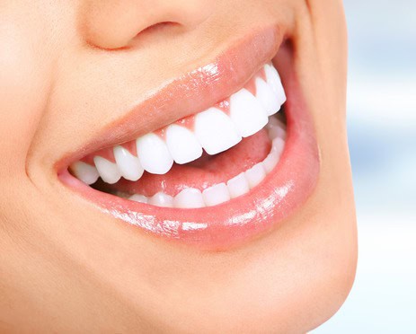 כללית סמייל צילום: shutterstockציפוי קומפוזיט